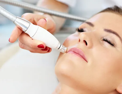 Épilation de la lèvre supérieure au laser